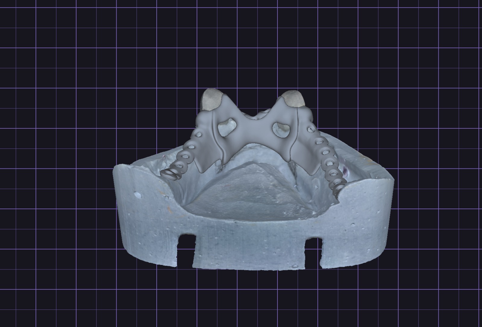 Vizual djelomične konstrukcije