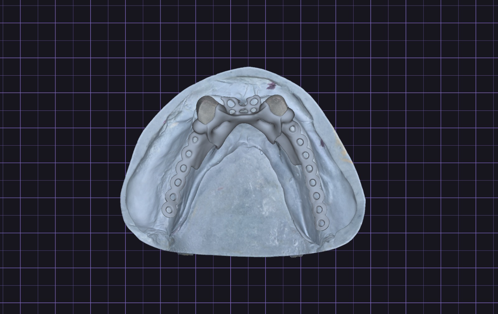 Parcijalni framework na modelu