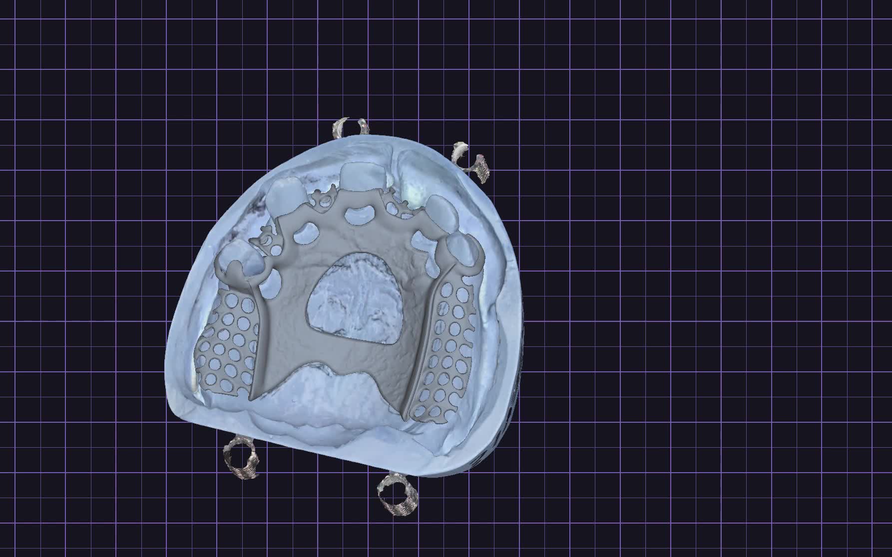 Poravnanje i analiza modela