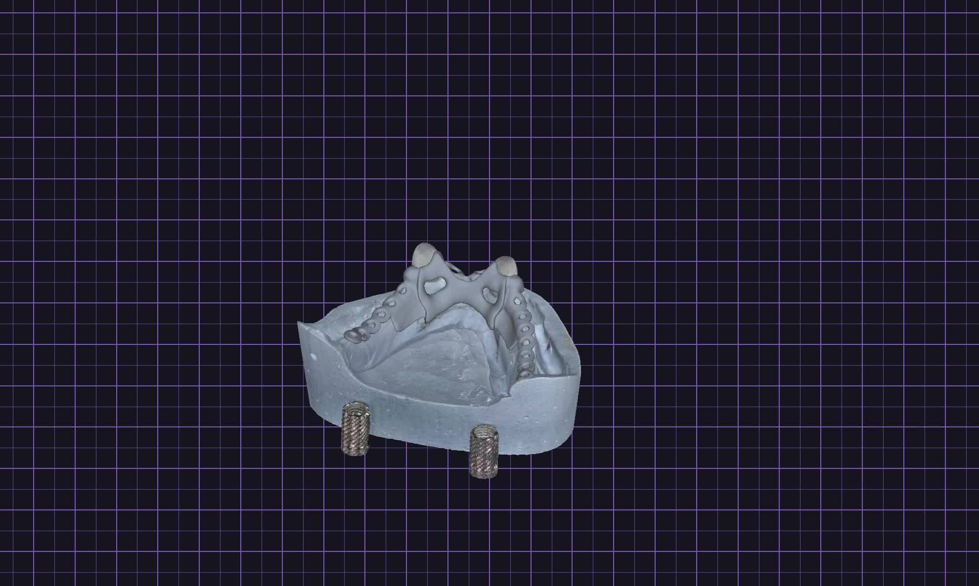 Konstrukcija na modelu