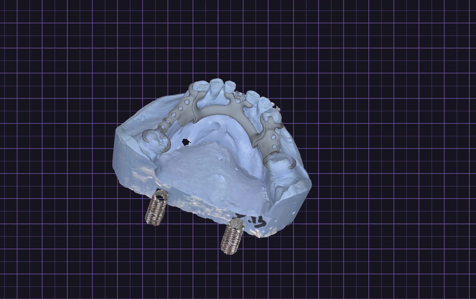 Detaljni kadar konstrukcije